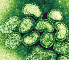 Swine flu claims third life in Odisha